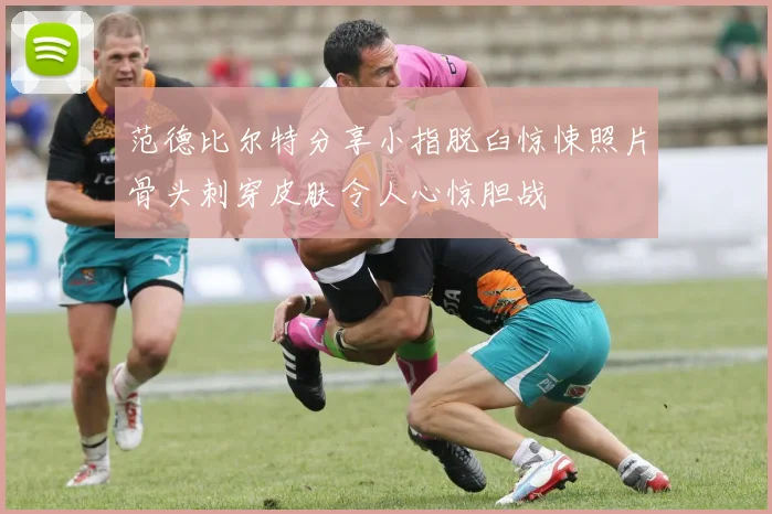 范德比尔特分享小指脱臼惊悚照片骨头刺穿皮肤令人心惊胆战